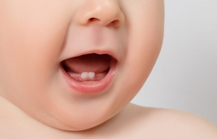 مراقبت از دندان کودک