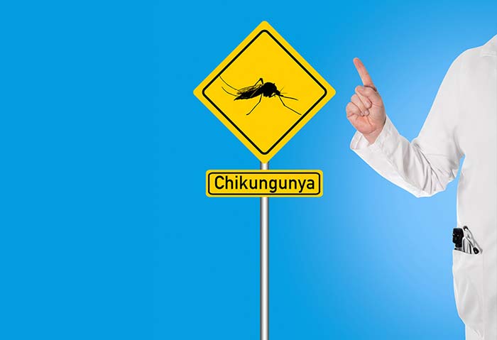 چیکونگونیا (Chikungunya)