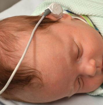 تست شنوایی سنجی نوزادان