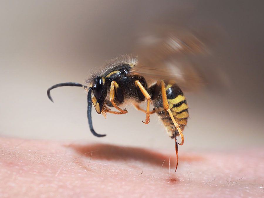 مقابله با نیش زنبور در کودکان
