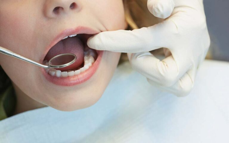 مشکلات رایج دهان و دندان در کودکان و راهکاری پیشگیری