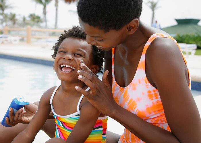 درمان آفتاب سوختگی در نوزادان و کودکان