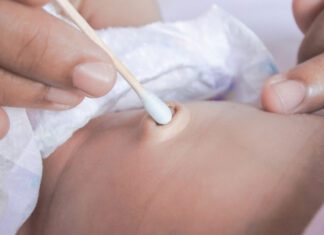 چگونه از بند ناف نوزاد مراقبت کنید؟ مراقبت از بند ناف نوزاد