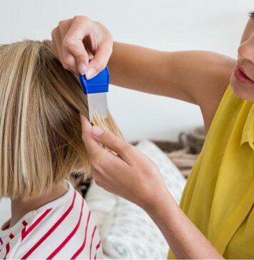 شپش سر در کودکان