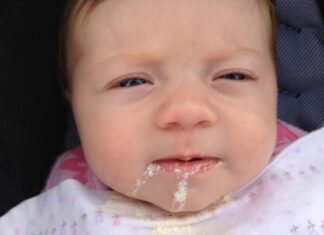 بالا آوردن شیر پنیری در نوزادان