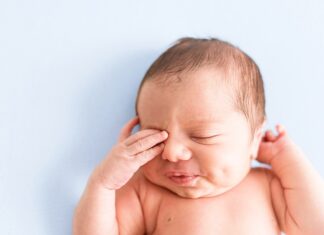 چشمان متورم در نوزادان